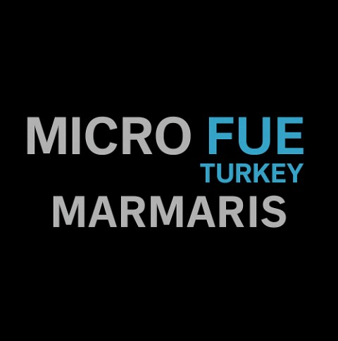 Why Micro FUE Turkey Marmaris