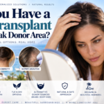 Can You Have a Hair Transplant With a Weak Donor Area?
